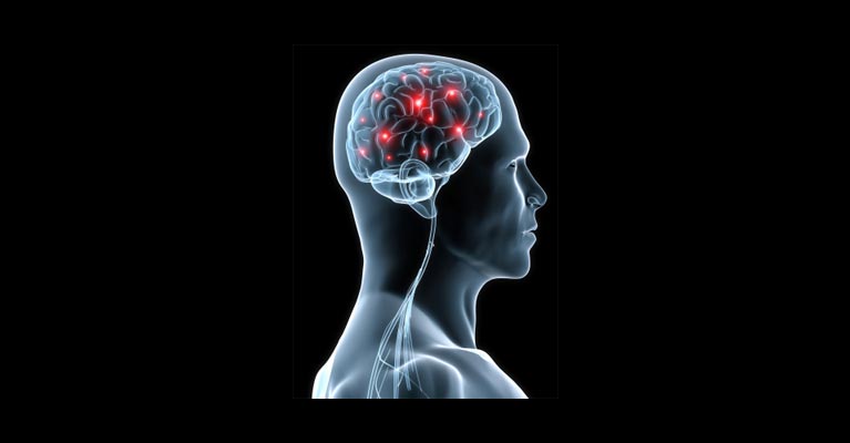 Image of a footballer's brain